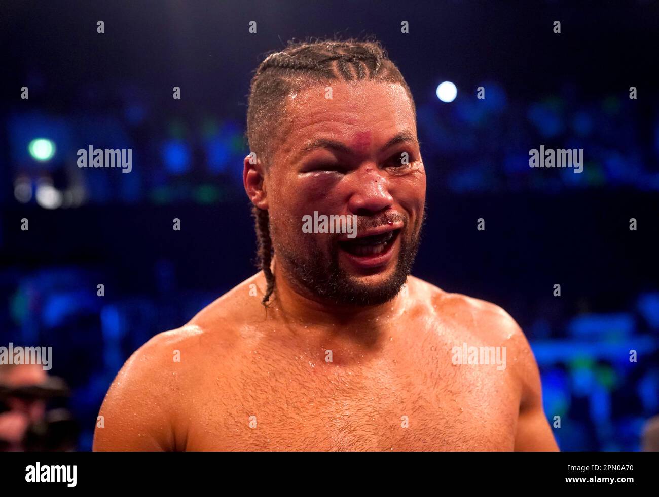 Joe Joyce after losing his WBO Interim World Heavyweight fight against