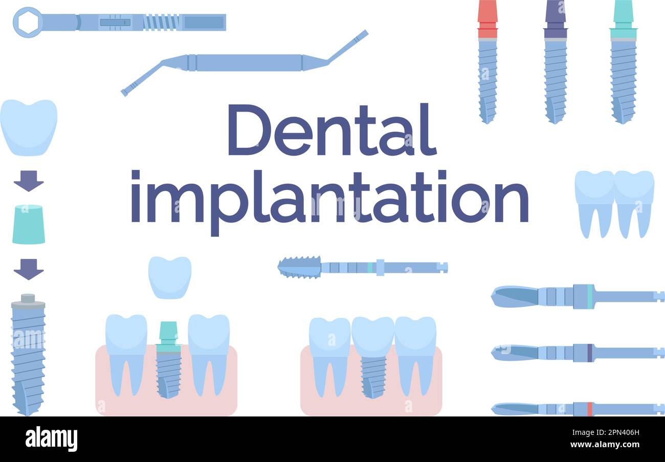 Dental tools for dental implants. Medical metal and titanium. Vector