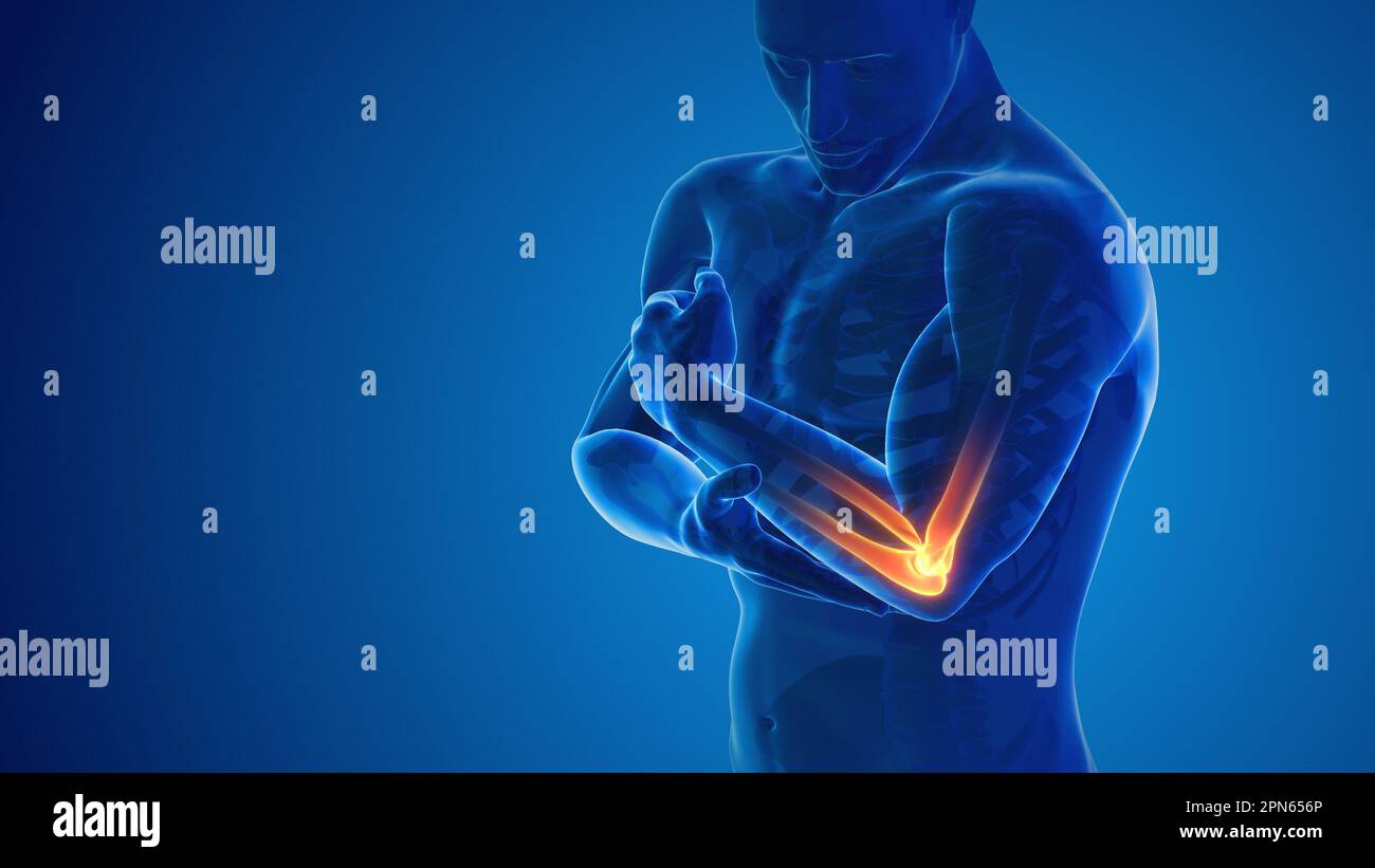 Pain in the elbow joint Stock Photo Alamy