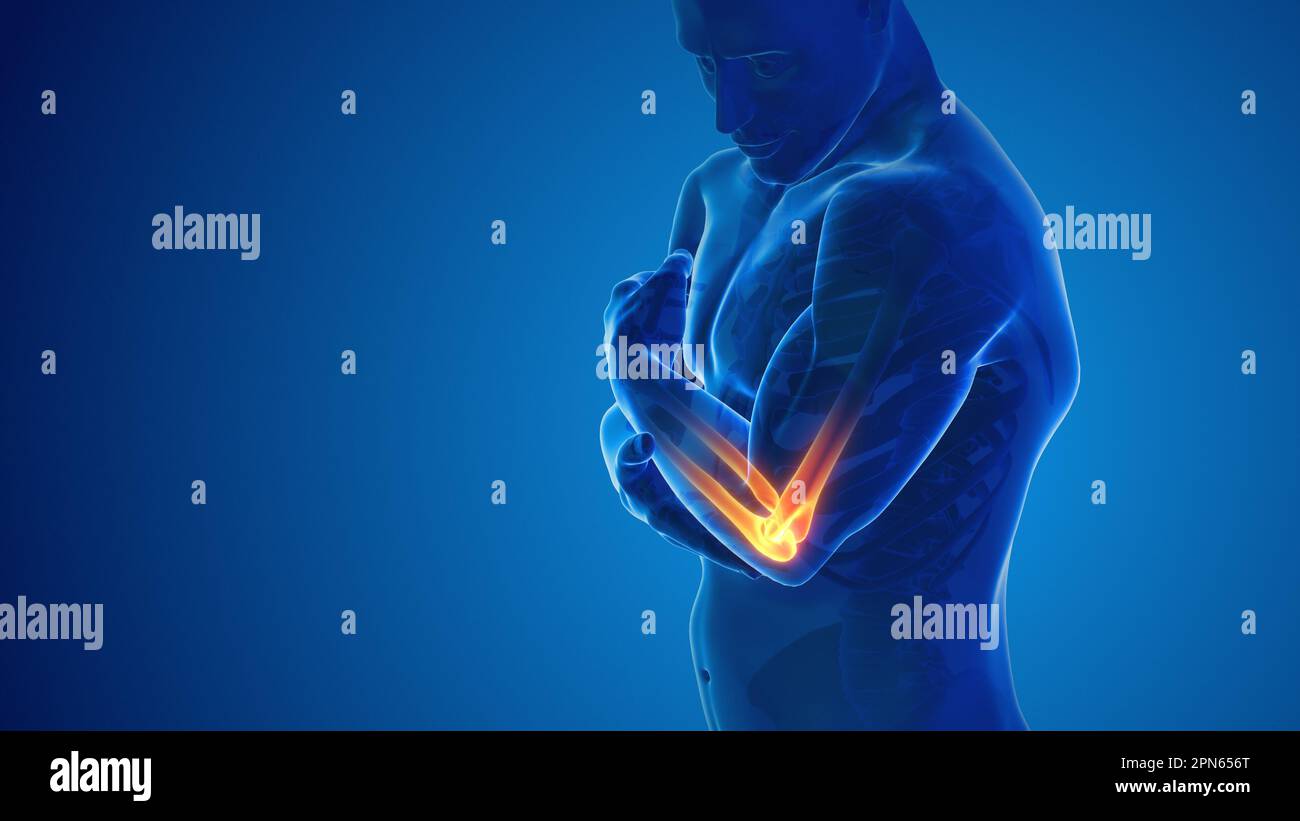 Pain in the elbow joint Stock Photo Alamy