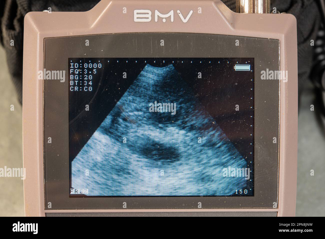 Pig pregnancy ultrasound scan picture Stock Photo