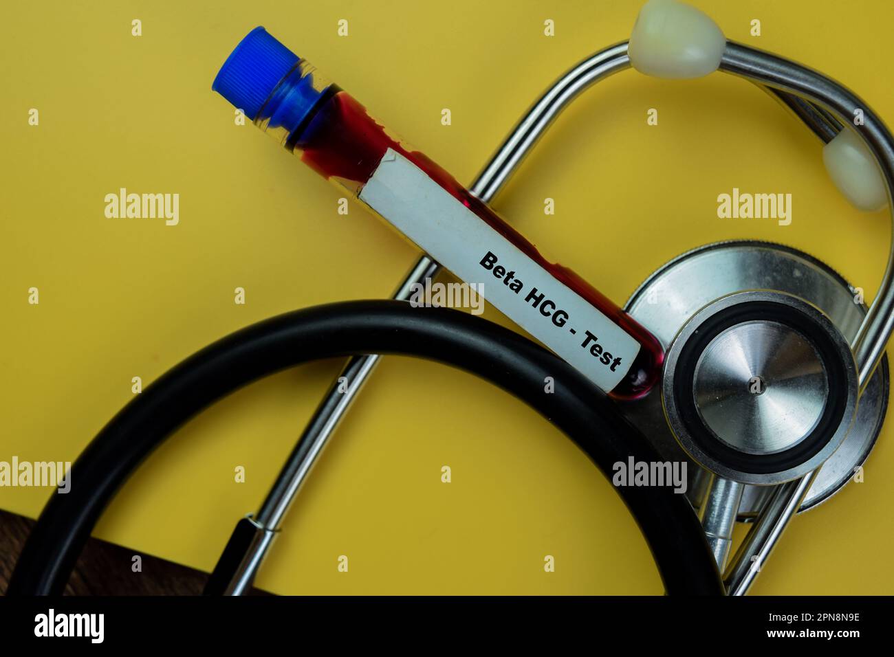 Concept of Beta HCG - Test with blood sample. Healthcare or medical ...