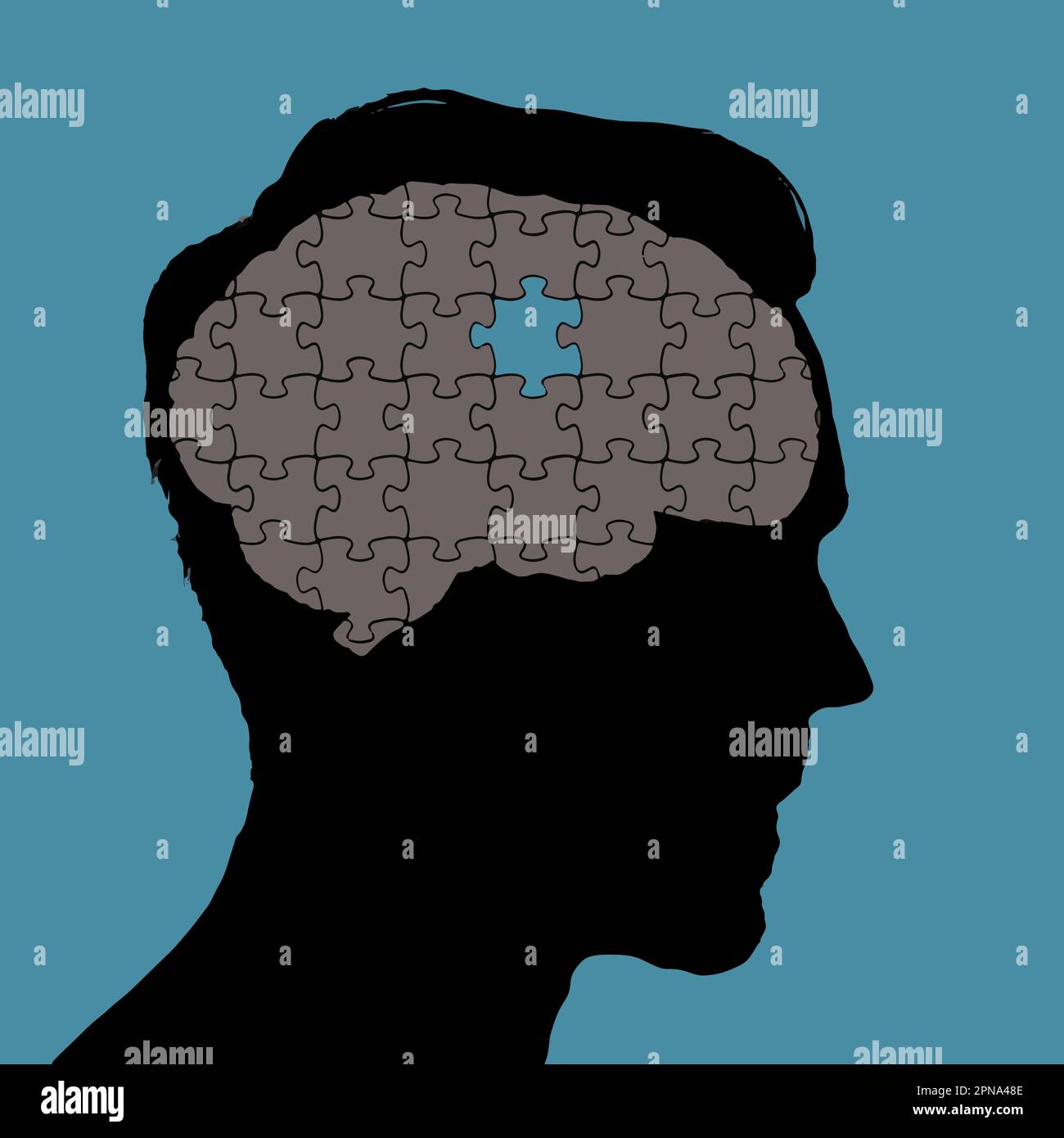 A damaged human brain is pictured as a jigsaw puzzle with a piece missing in a vector illustration. Stock Vector