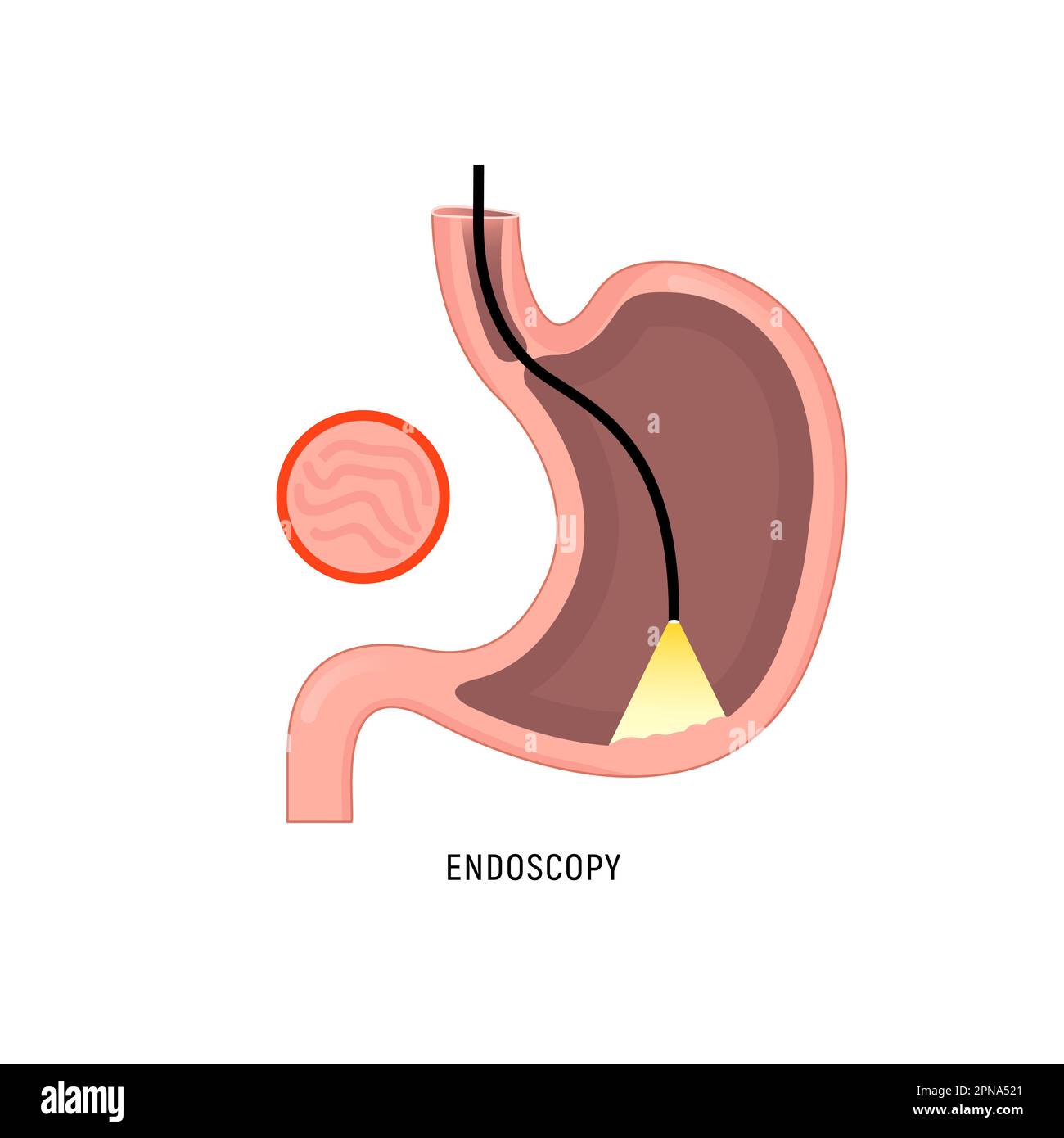 xion-gmbh-products-for-endoscopy-xion-swallowing