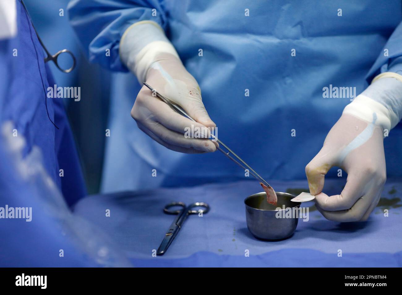 Tam Duc Cardiology Hospital. Operating theater. Cardiac surgery