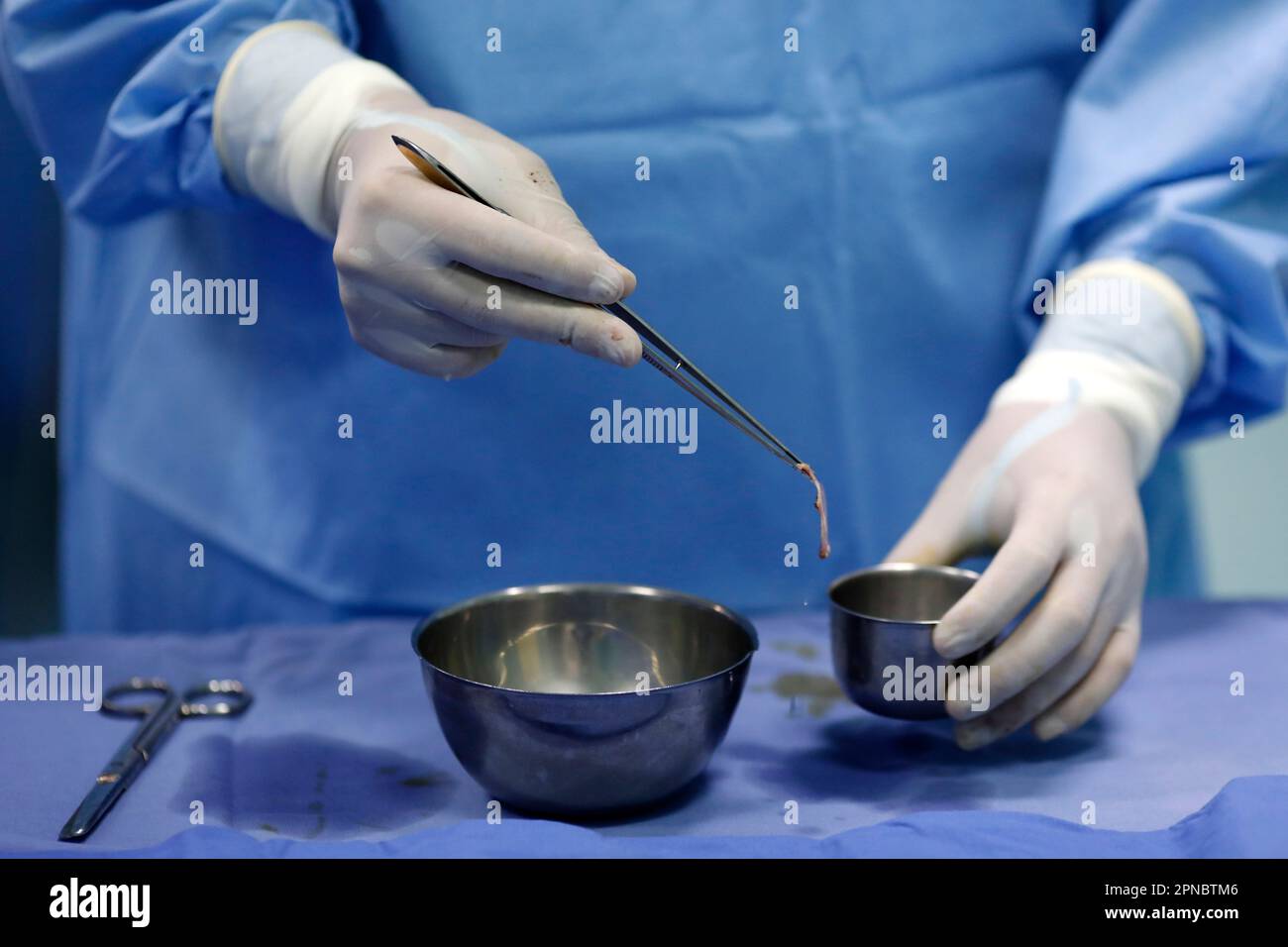 Tam Duc Cardiology Hospital. Operating theater. Cardiac surgery