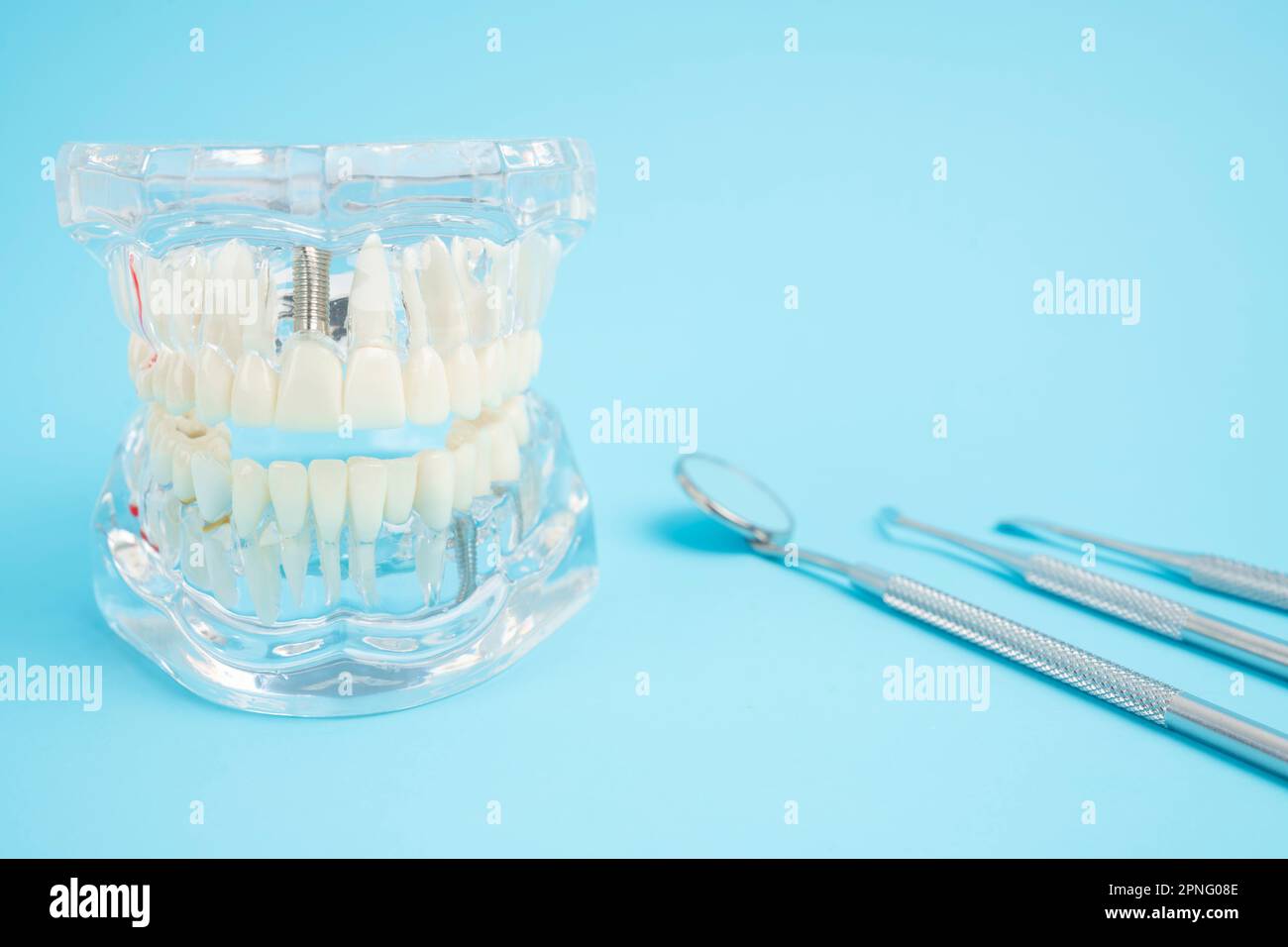 Human jaw or Acrylic dentures model with implants and dental tools on blue background Stock
