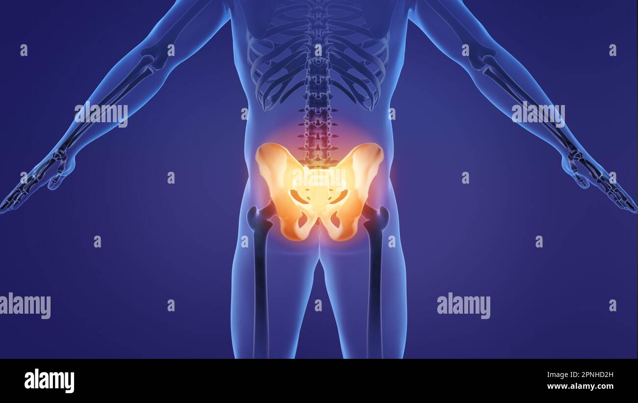 Animation of a painful pelvic girdle Stock Photo