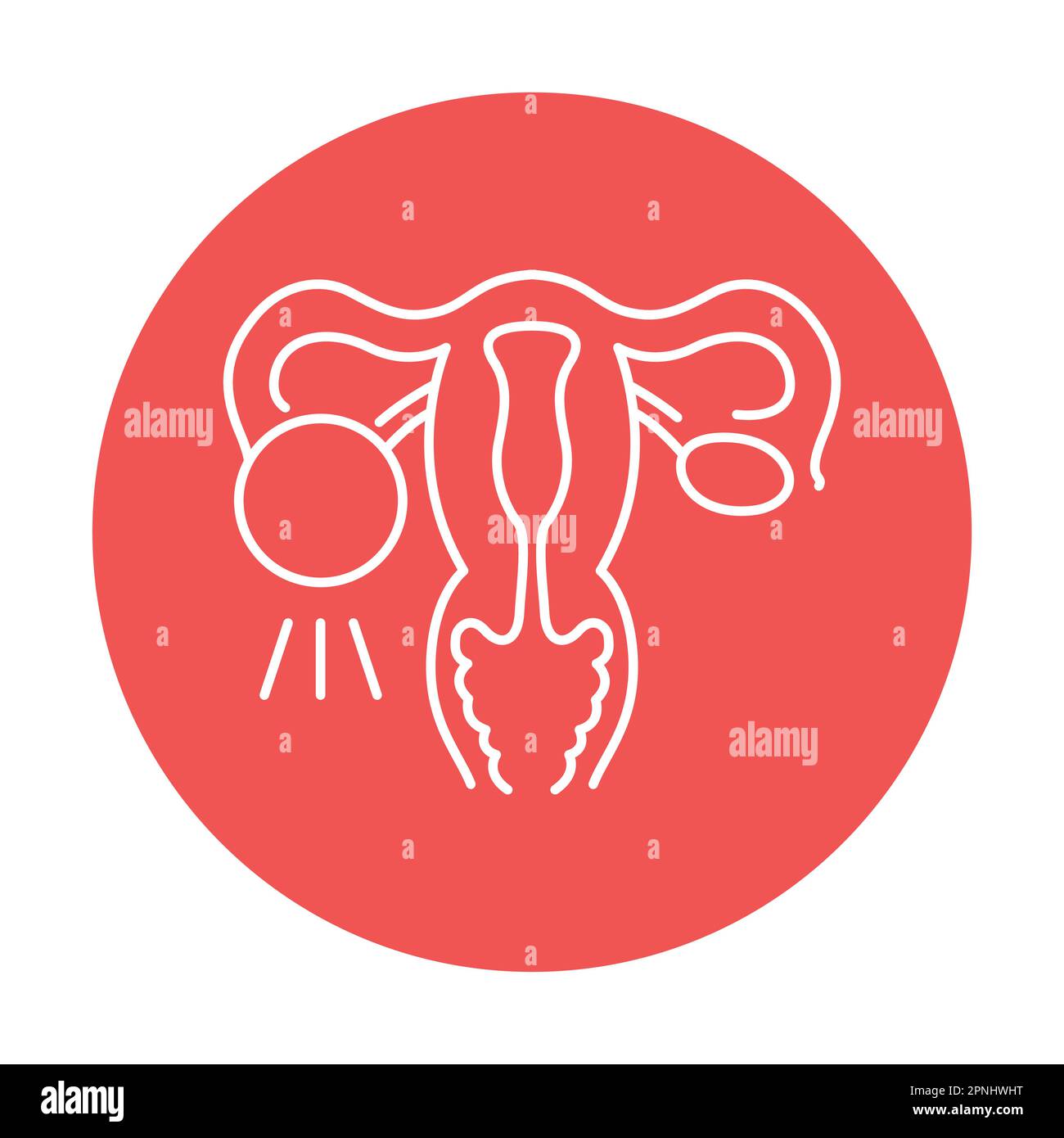 Polycystic ovary syndrome color line icon. Human diseases. Pictogram ...