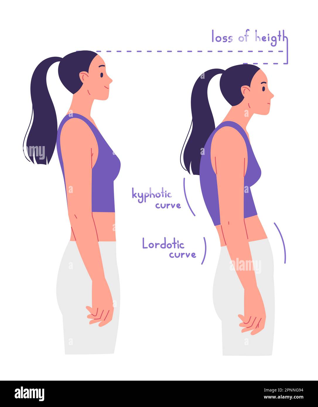 Correct and incorrect posture. The disadvantages of poor posture and