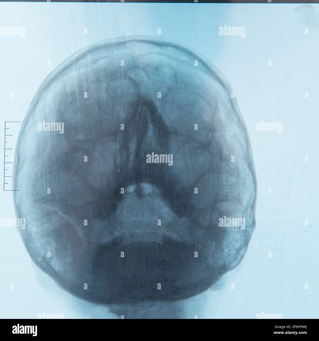 Human brain on MRI scans Frontal Stock Photo