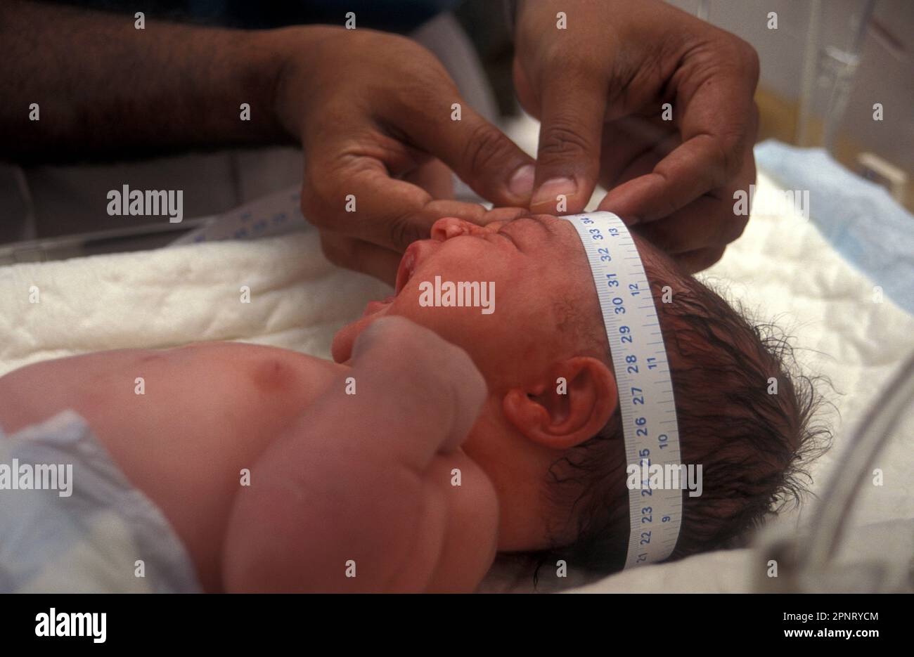 midwife of west indian origin measuring fetal head circumference of newborn baby with elongated head due to prolonged labour Stock Photo