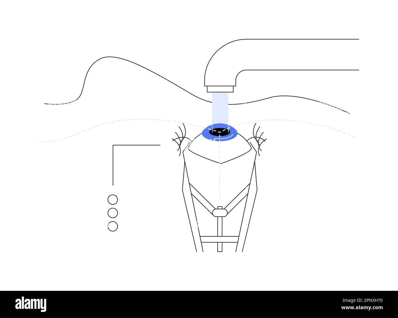 Cataract surgery procedure abstract concept vector illustration Stock