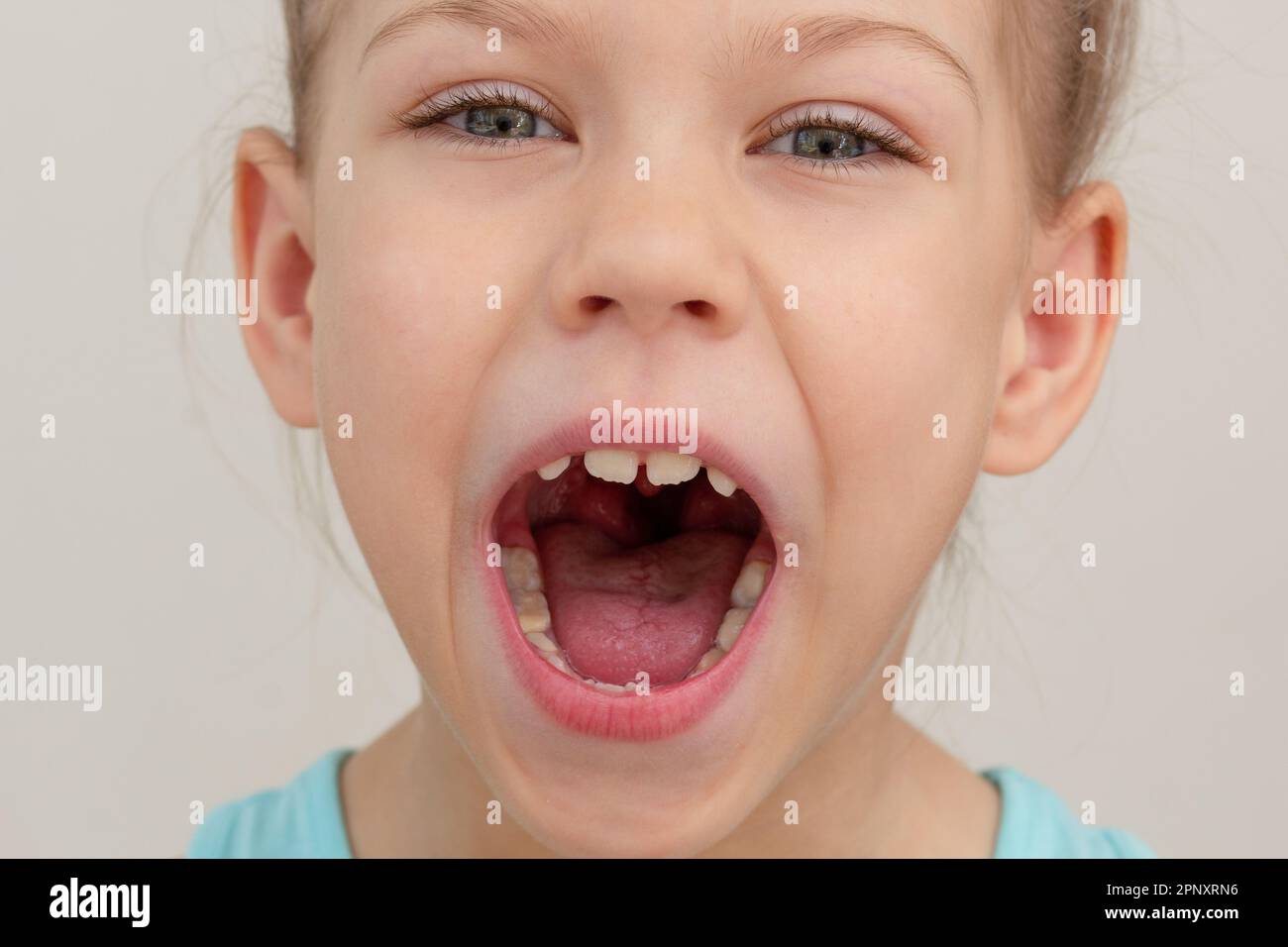 Child face with wide opened mouth cropped head caucasian little girl of 6 7 years on grey background Stock Photo