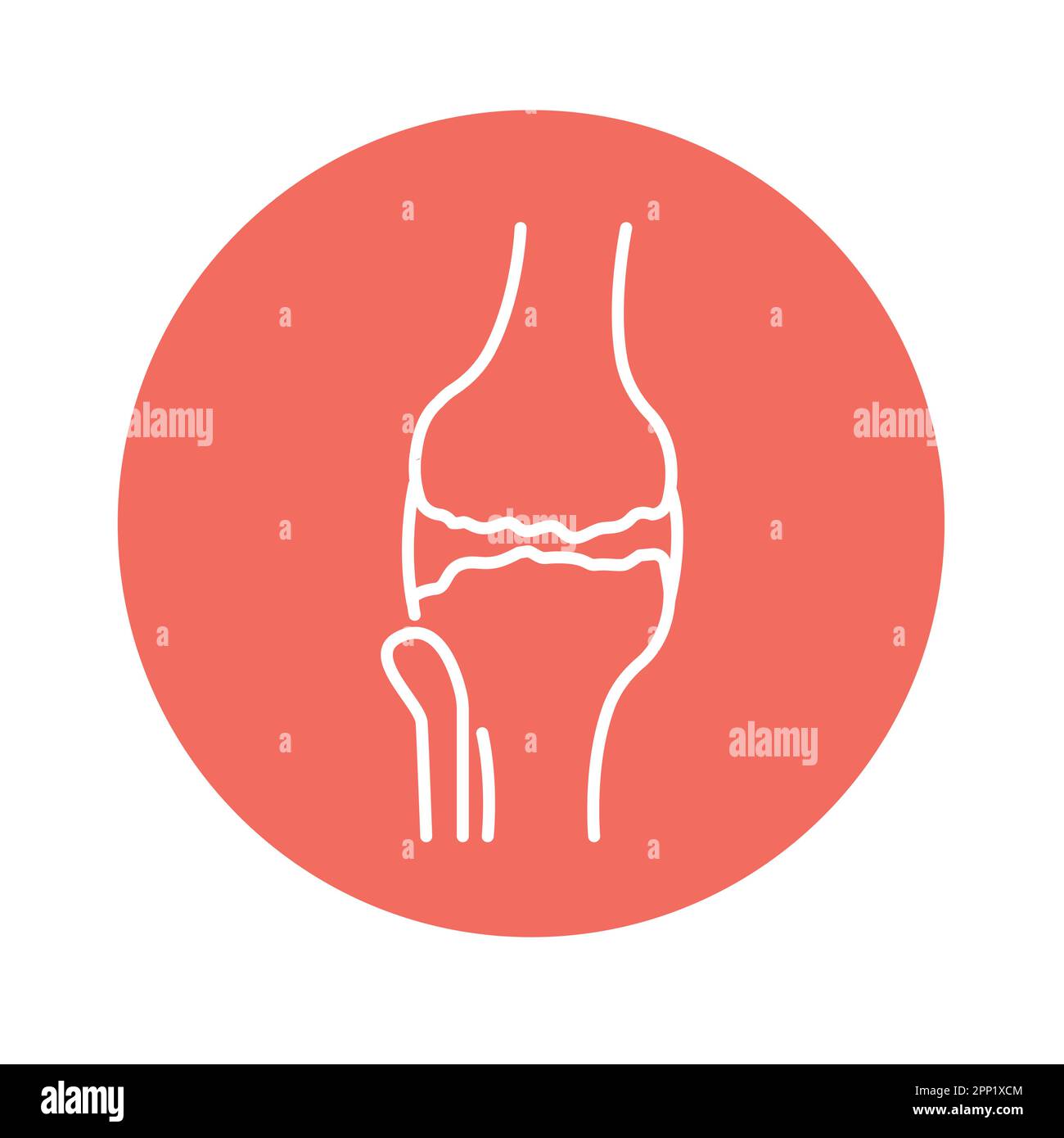is gabapentin for osteoarthritis
