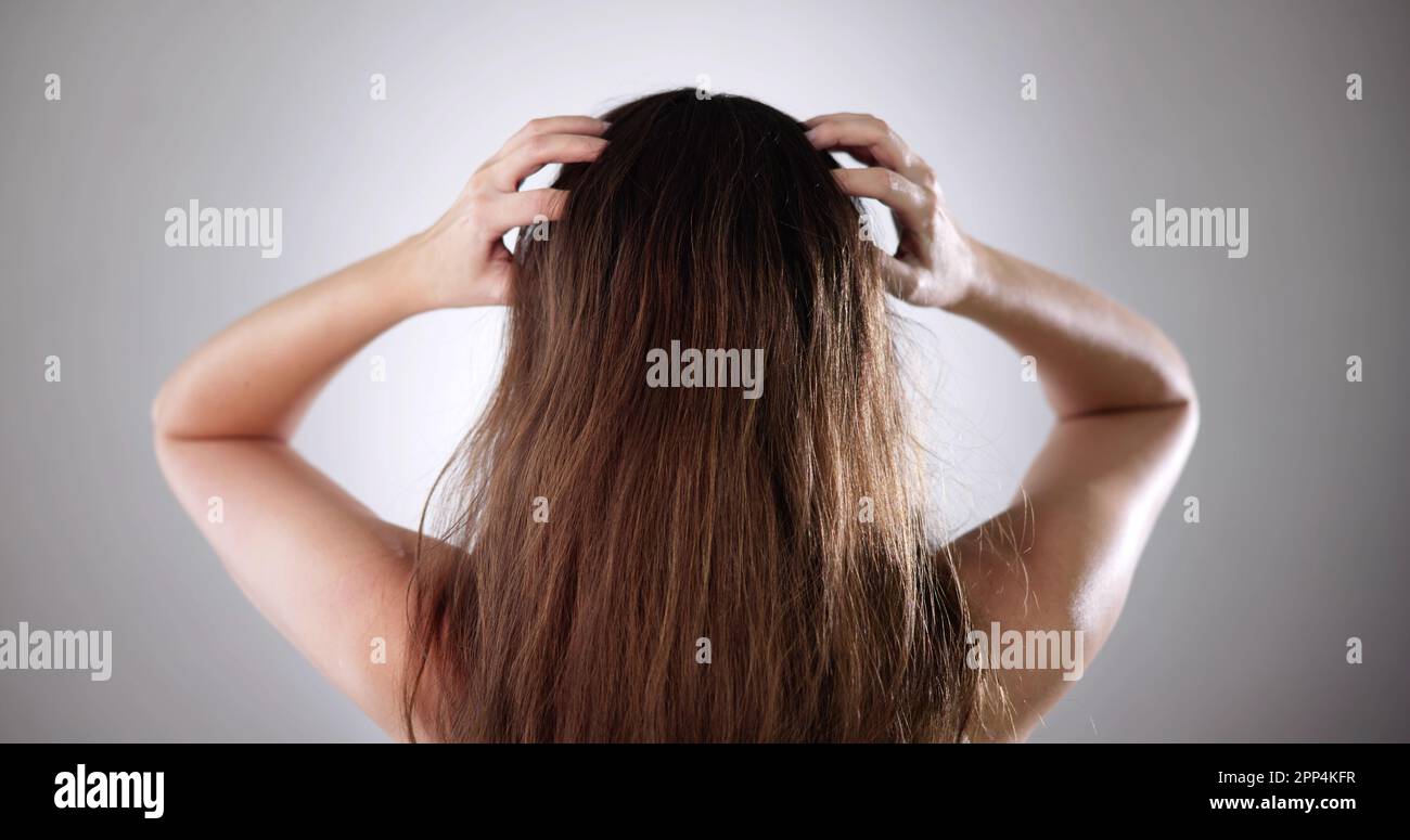 Itching Dry Head Scalp And Long Hair With Dandruff Stock Photo Alamy