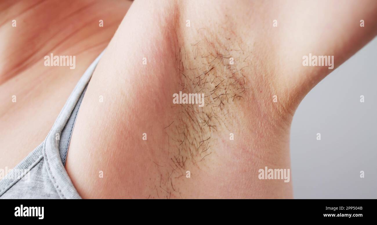 Young Woman With Hairy Armpit. Hair Removal And Shaving Stock Photo