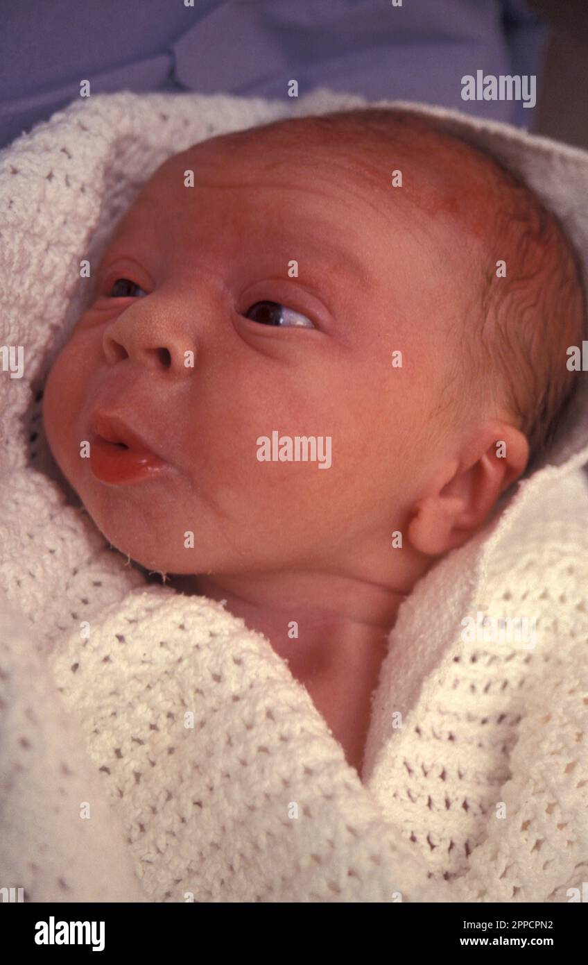 newborn baby with elongated head following prolonged labour Stock Photo