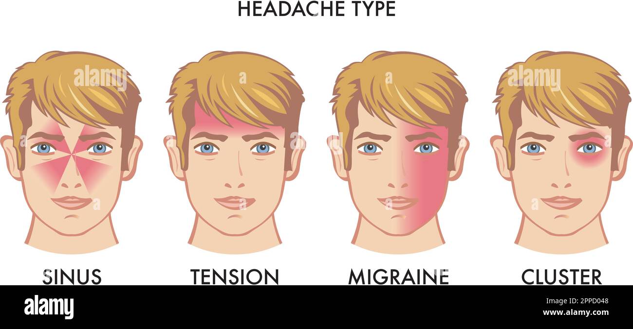 Illustration of types of headache Stock Vector