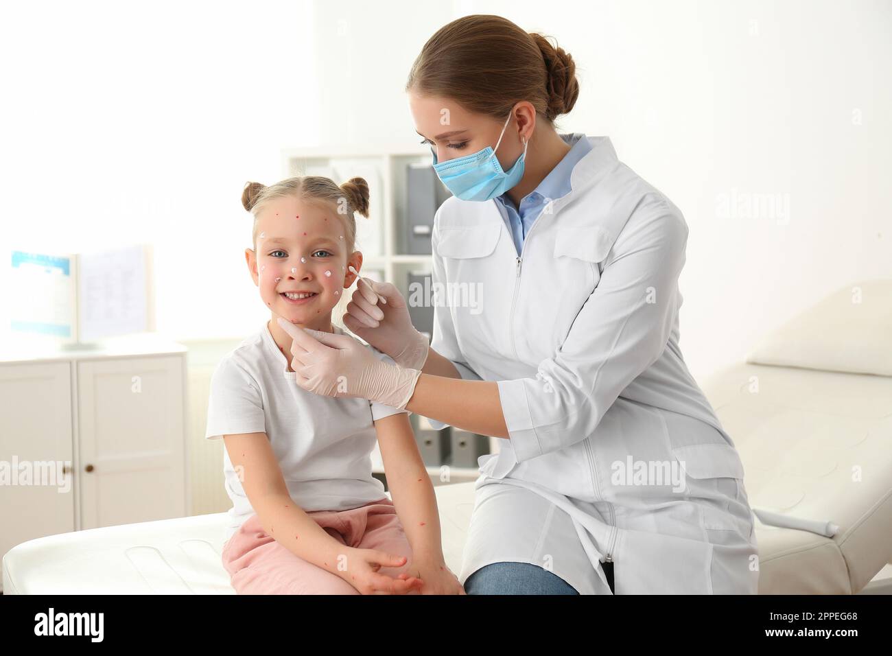 Chickenpox Doctor Doctor applying cream onto skin of little girl with chickenpox in ...
