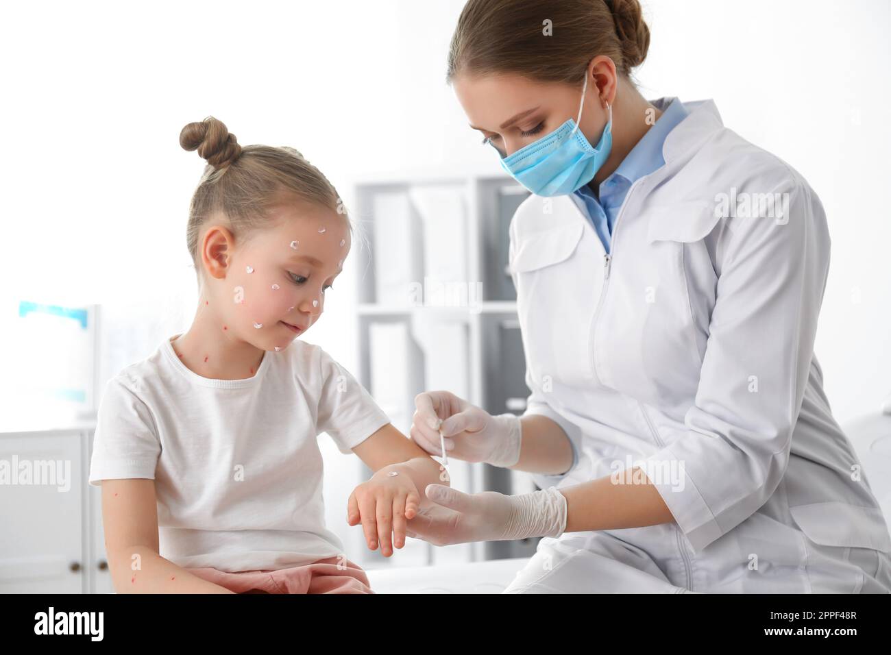 Chickenpox Doctor Doctor applying cream onto skin of little girl with chickenpox in ...