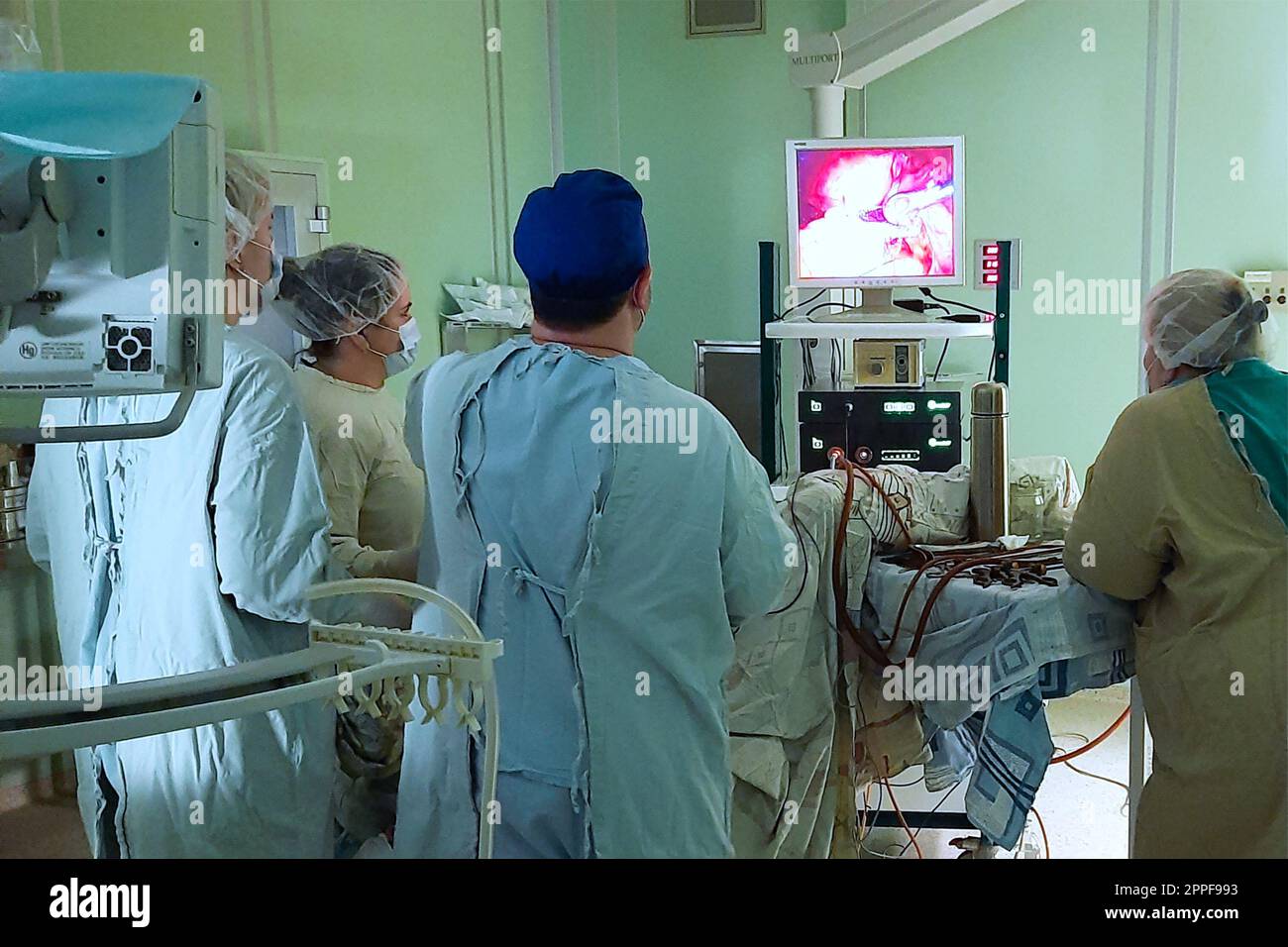 Real laparoscopic surgery. Team of surgeons look at the monitor during the operation Stock Photo