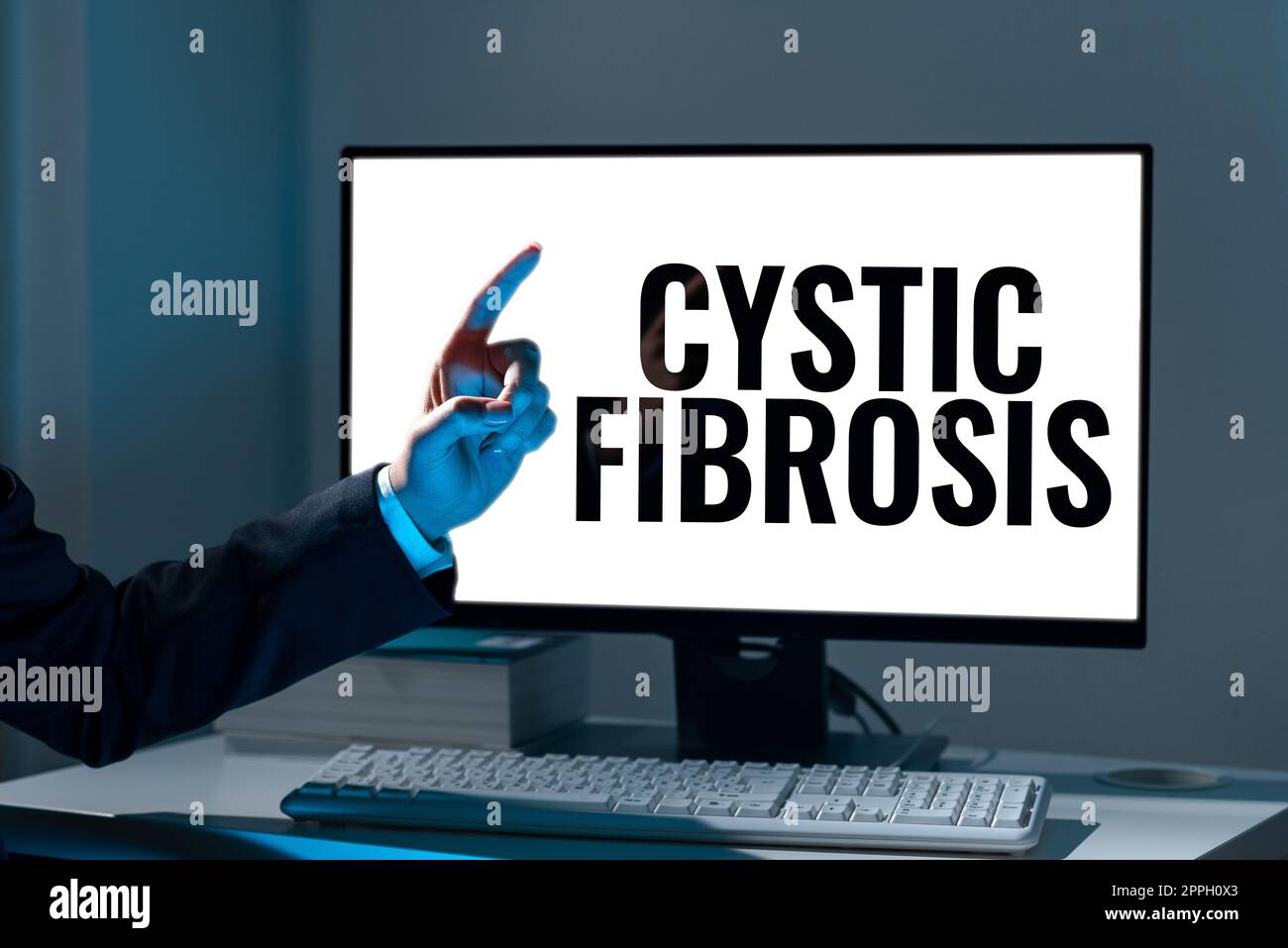 Inspiration showing sign Cystic Fibrosis. Business concept a hereditary disorder affecting the exocrine glands Stock Photo