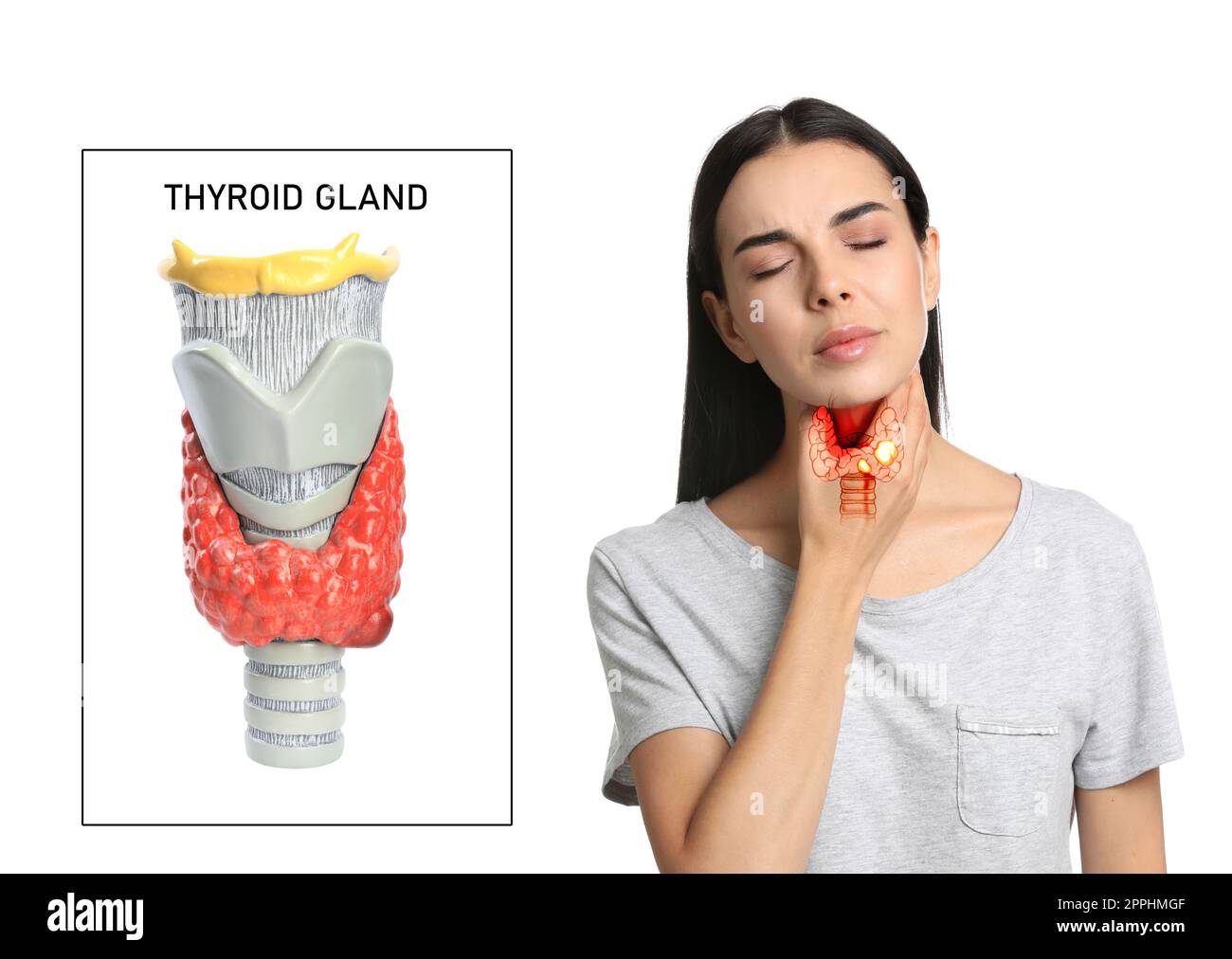 Woman with thyroid gland disease and model of organ on white background