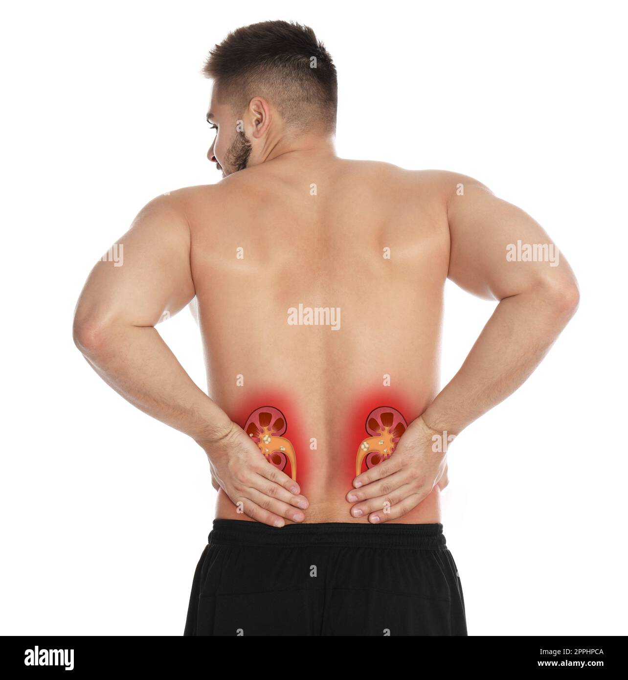 Man suffering from pain because of kidney stones disease on white