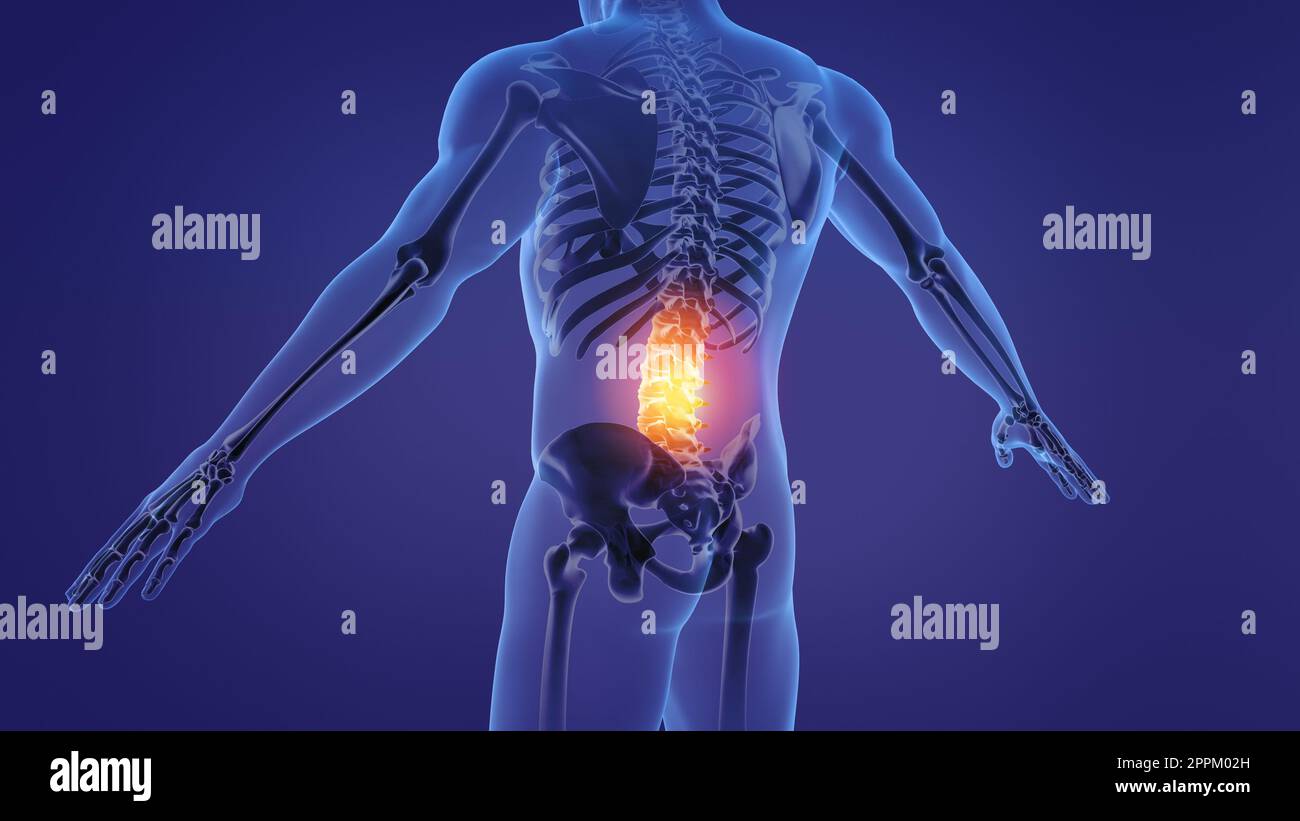 Image of lumbar spine hi-res stock photography and images - Alamy