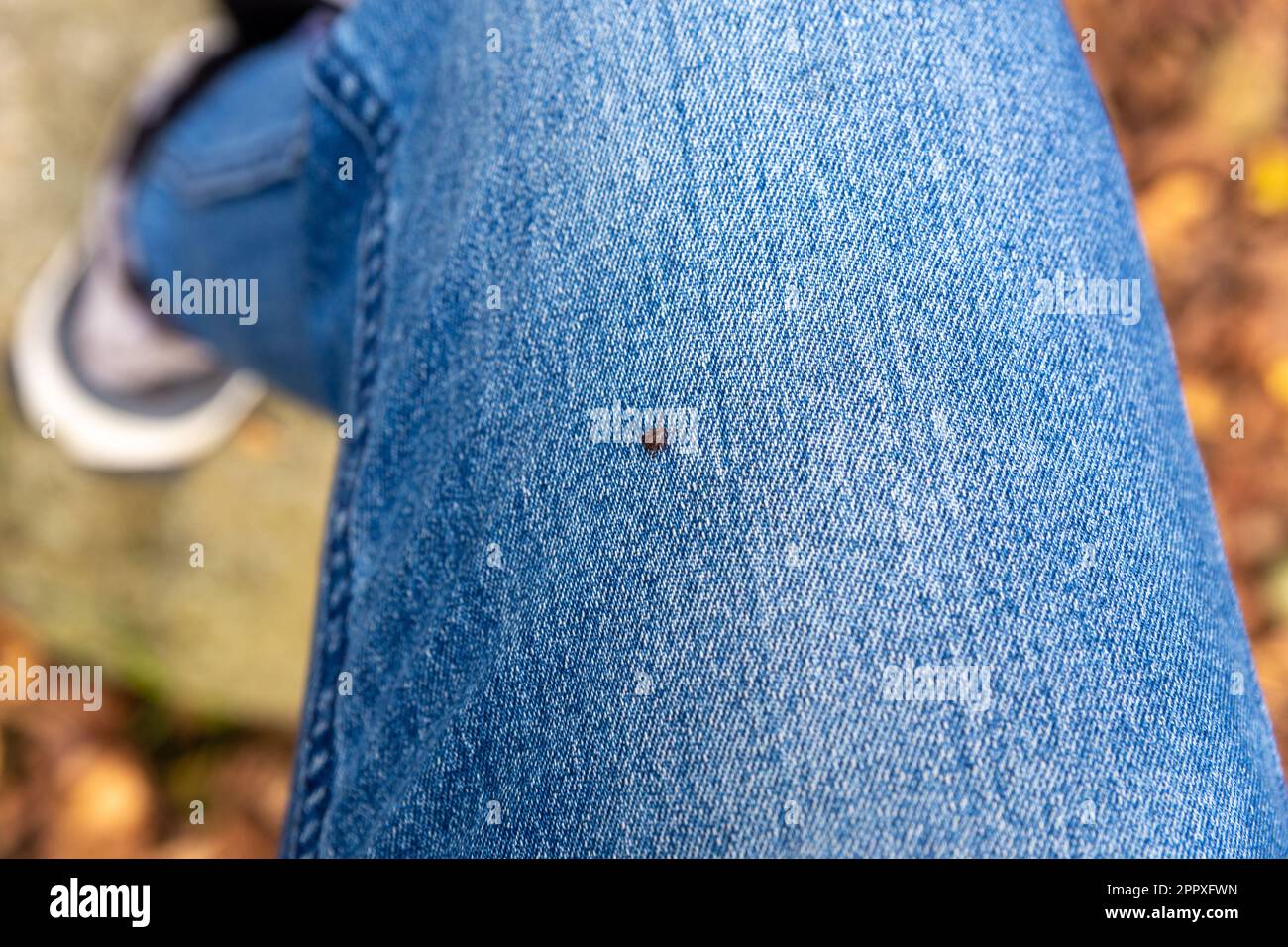 Lyme disease black person hi-res stock photography and images - Alamy