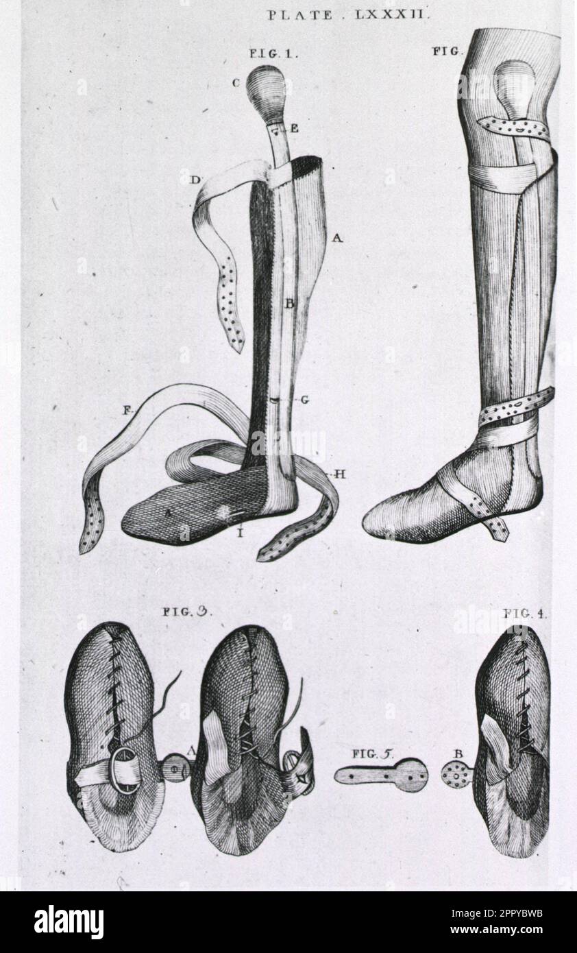 Leg braces and corrective shoes Stock Photo Alamy