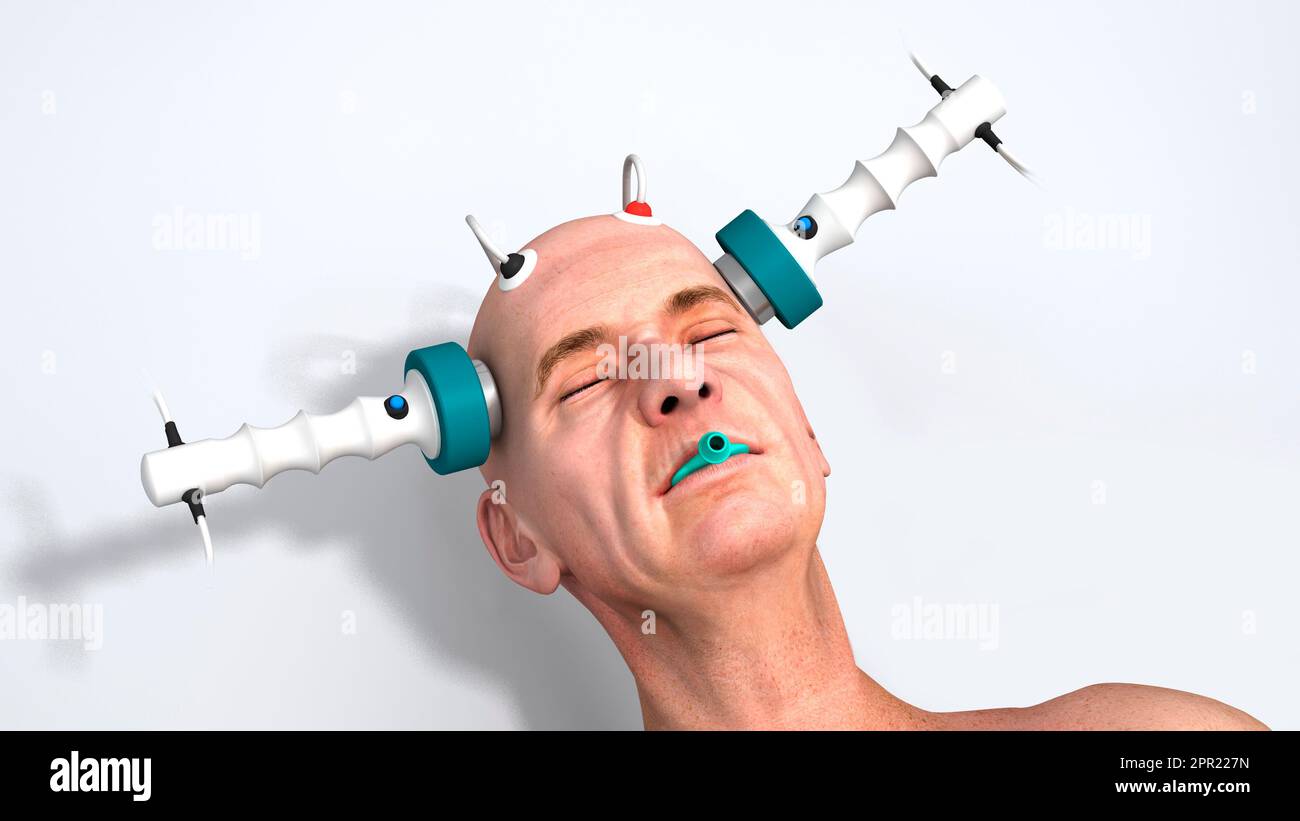 Electroconvulsive therapy, illustration Stock Photo - Alamy