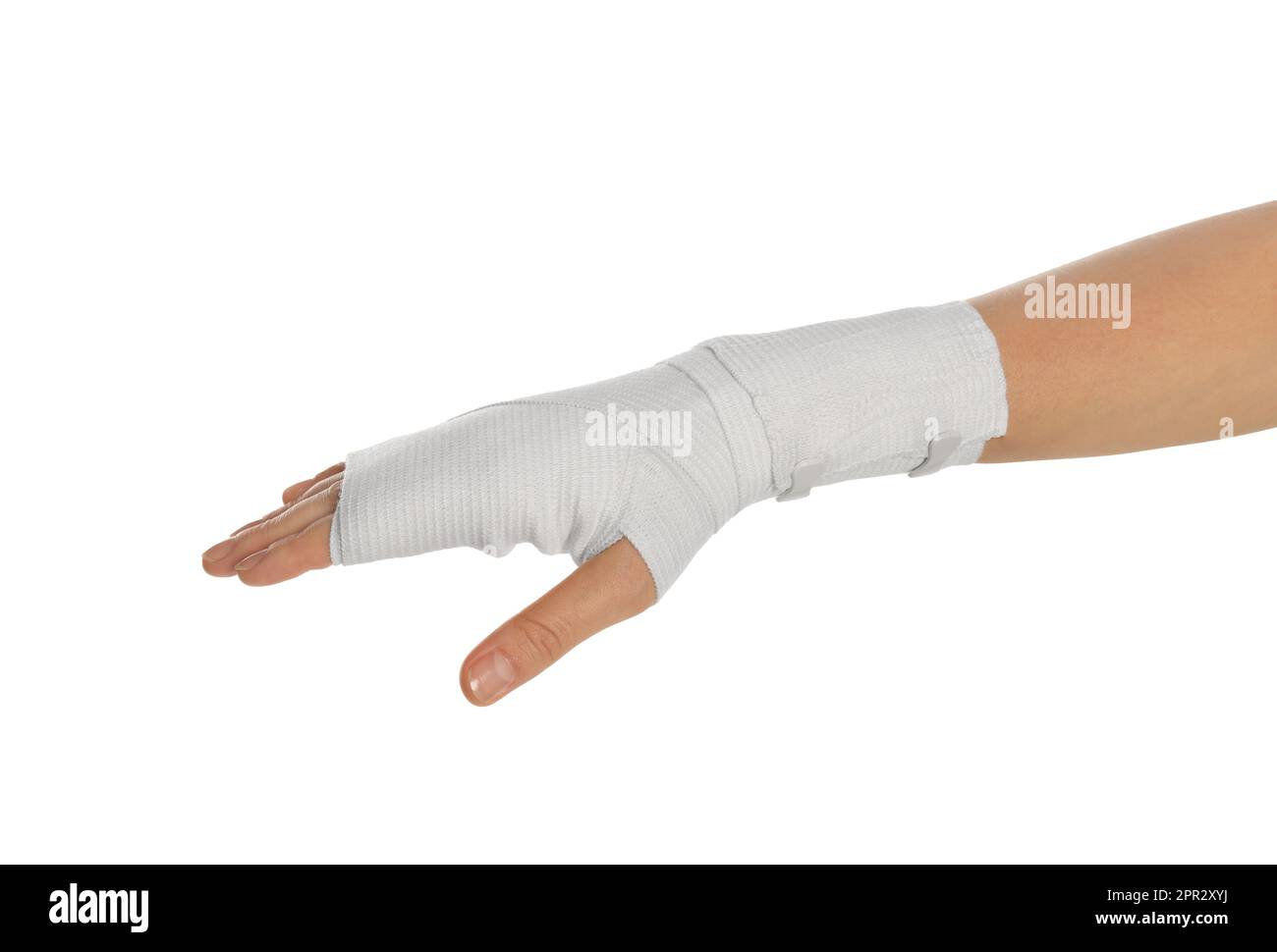 Hand in Cast on White Background Stock Photo - Image of closeup