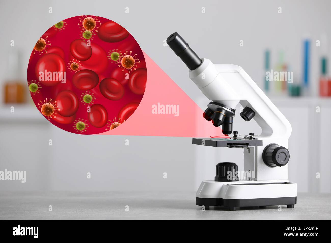 Examination of blood sample with germs under microscope in laboratory