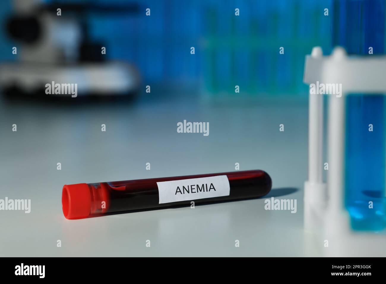Test tube with blood sample and label Anemia on white table against