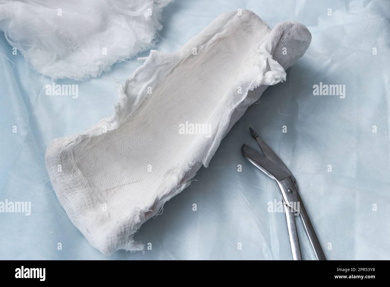 Cast removed from a broken arm after recovery Stock Photo Alamy