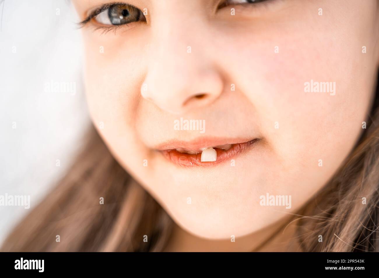 Charming smiling little girl kid with opened mouth shows staggering loose falling out first baby milk front tooth. Preschooler teeth changing. Healthy Stock Photo