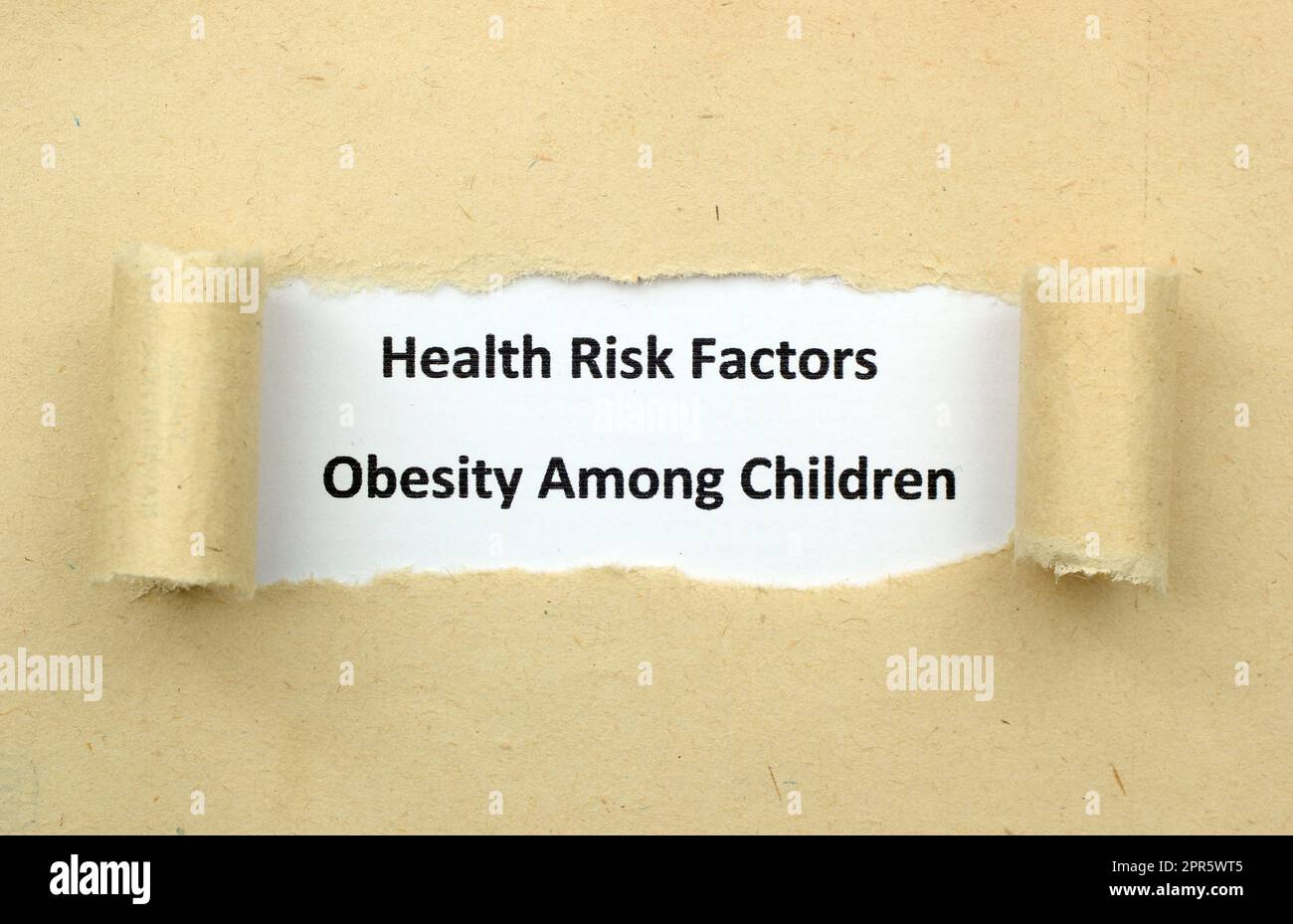 Child obesity Stock Photo