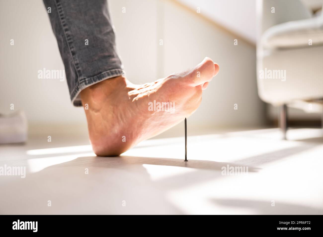 Foot Pin Accident. Tetanus Feet Ache. Leg Injury Stock Photo Alamy