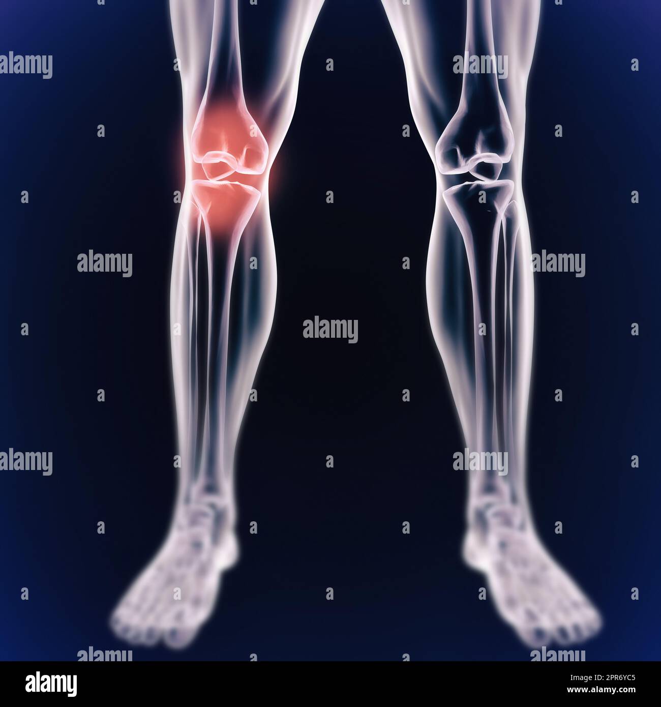 Knee and joint pains. When inflammation strikes. Illustration of the human body indicating the skeletal structure. Stock Photo