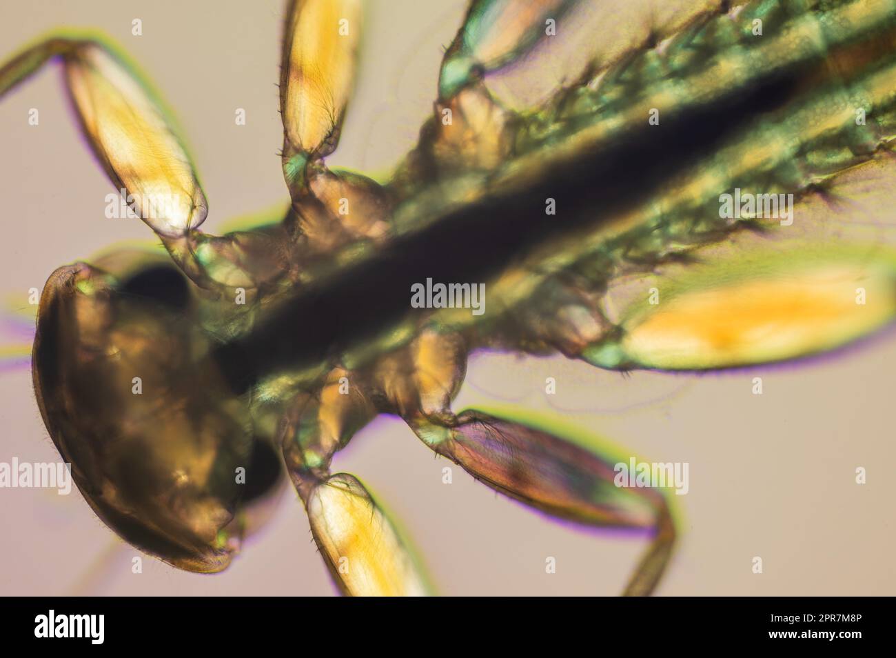 Head and legs of Yellow may dun Heptagenia sulphurea photographed in cross-polarised light with a wave retarder Stock Photo