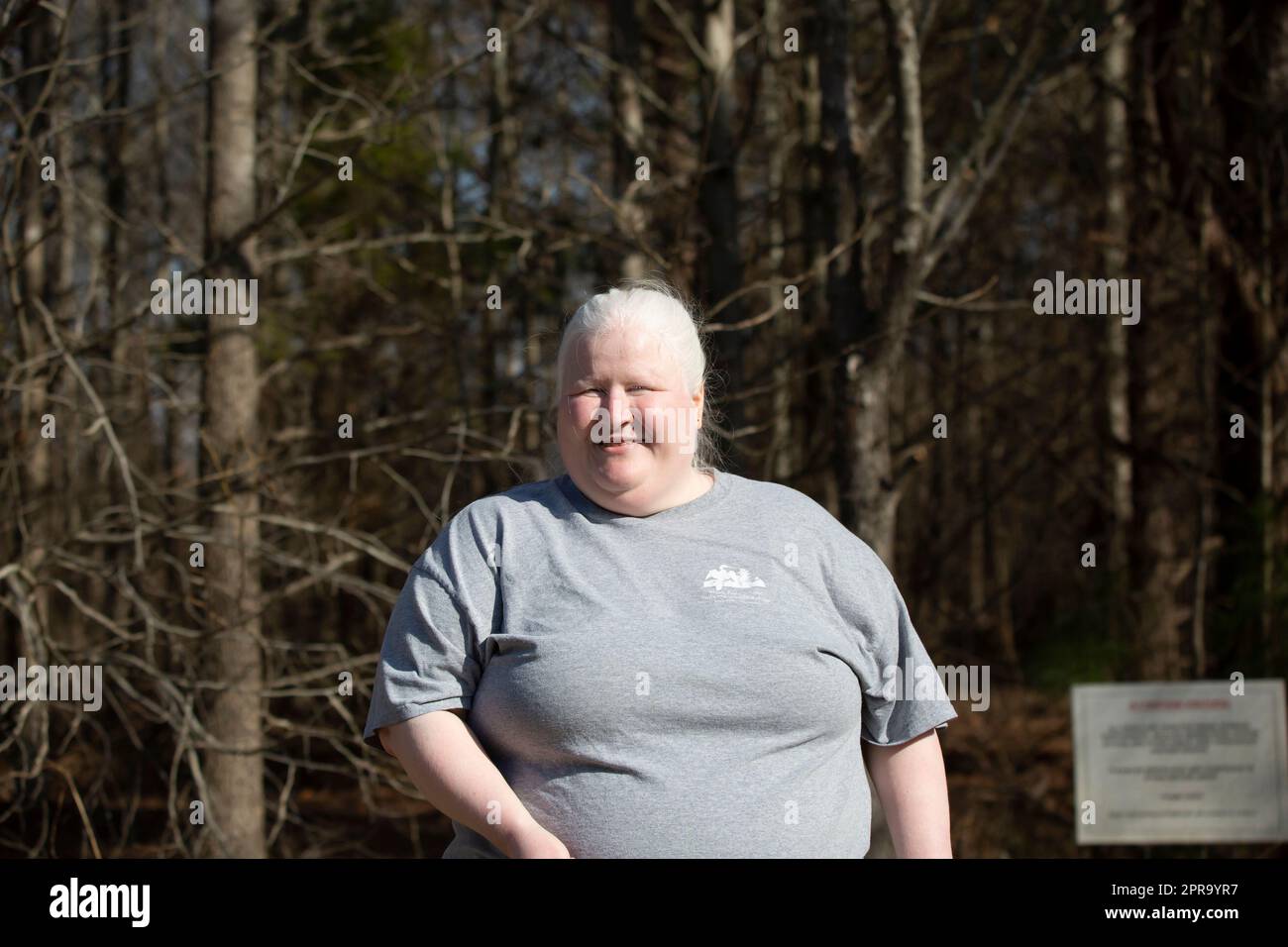 Albino woman hi-res stock photography and images - Alamy