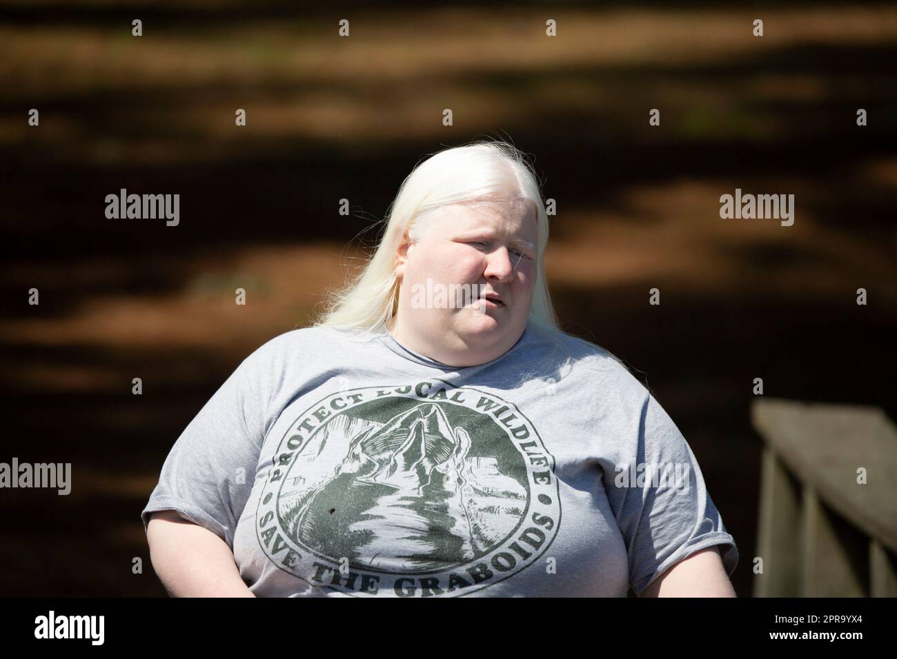 Albino girl hi-res stock photography and images - Alamy