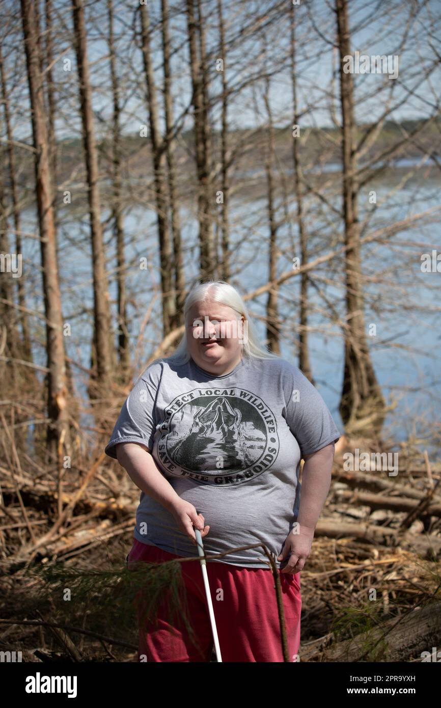 Albino girl hi-res stock photography and images - Alamy