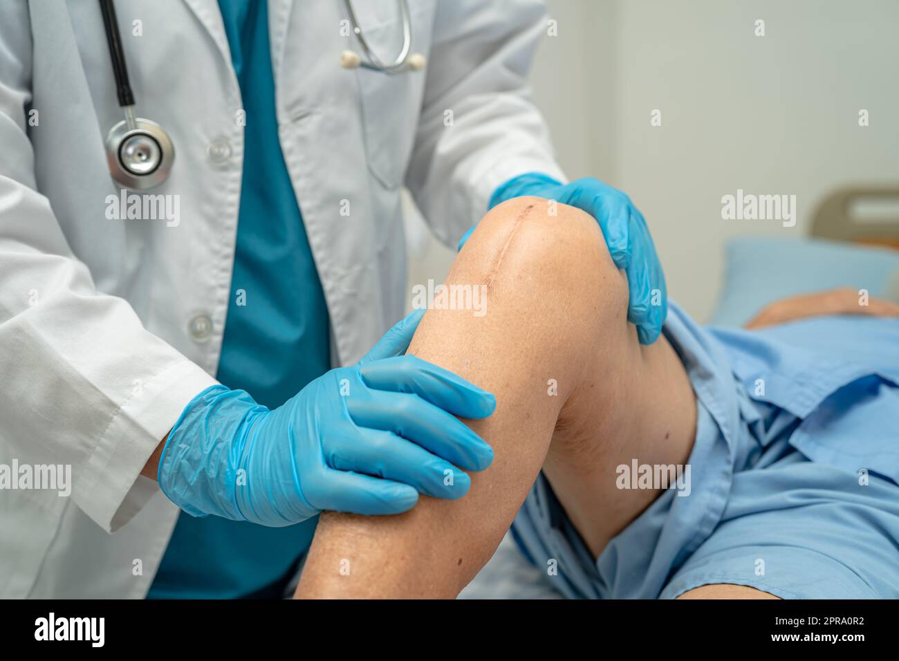 Doctor check Asian senior or elderly old lady woman patient scars surgical total knee joint replacement Suture wound surgery arthroplasty on bed in nursing hospital ward, healthy strong medical concept. Stock Photo