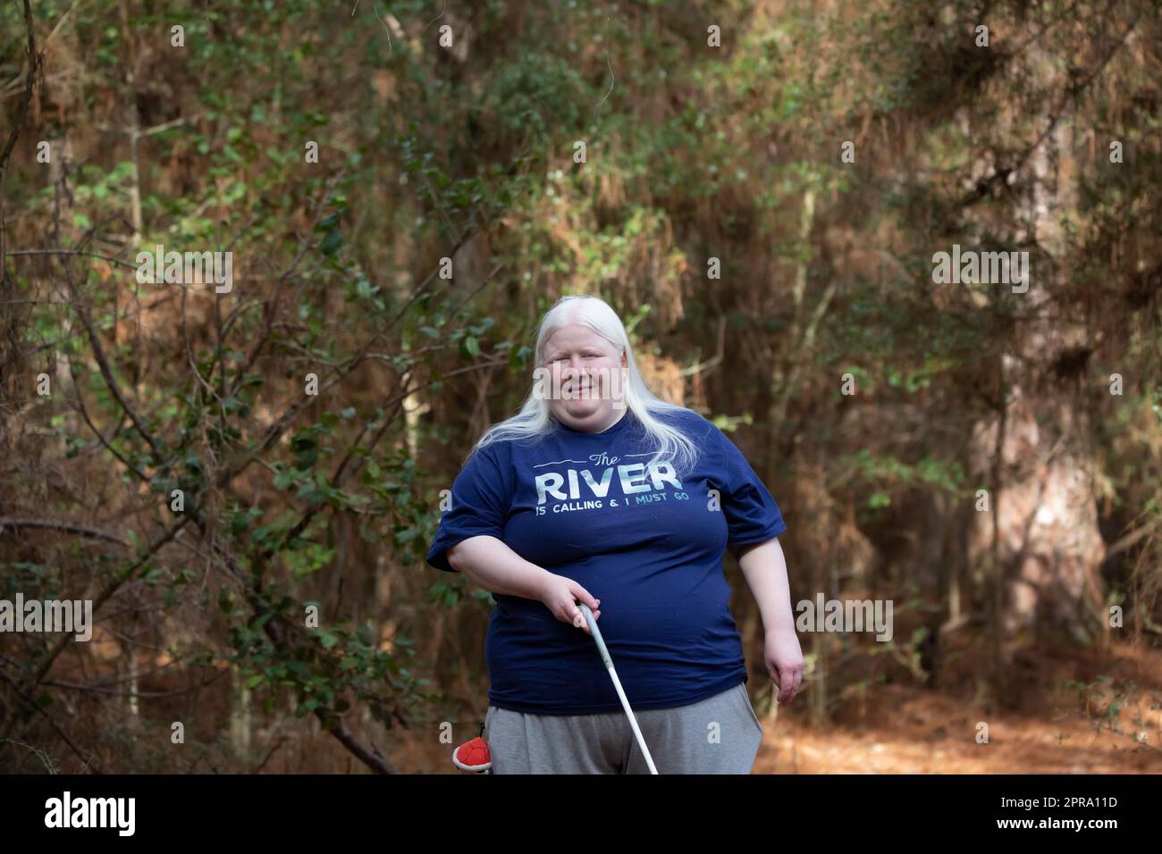 Albino woman hi-res stock photography and images - Alamy
