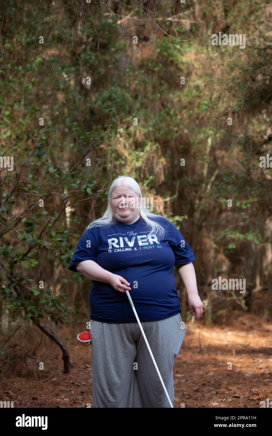 Albino woman hi-res stock photography and images - Alamy