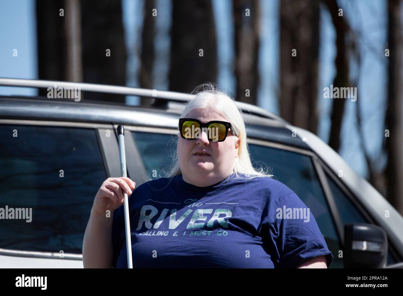 White female human albino hi-res stock photography and images - Alamy