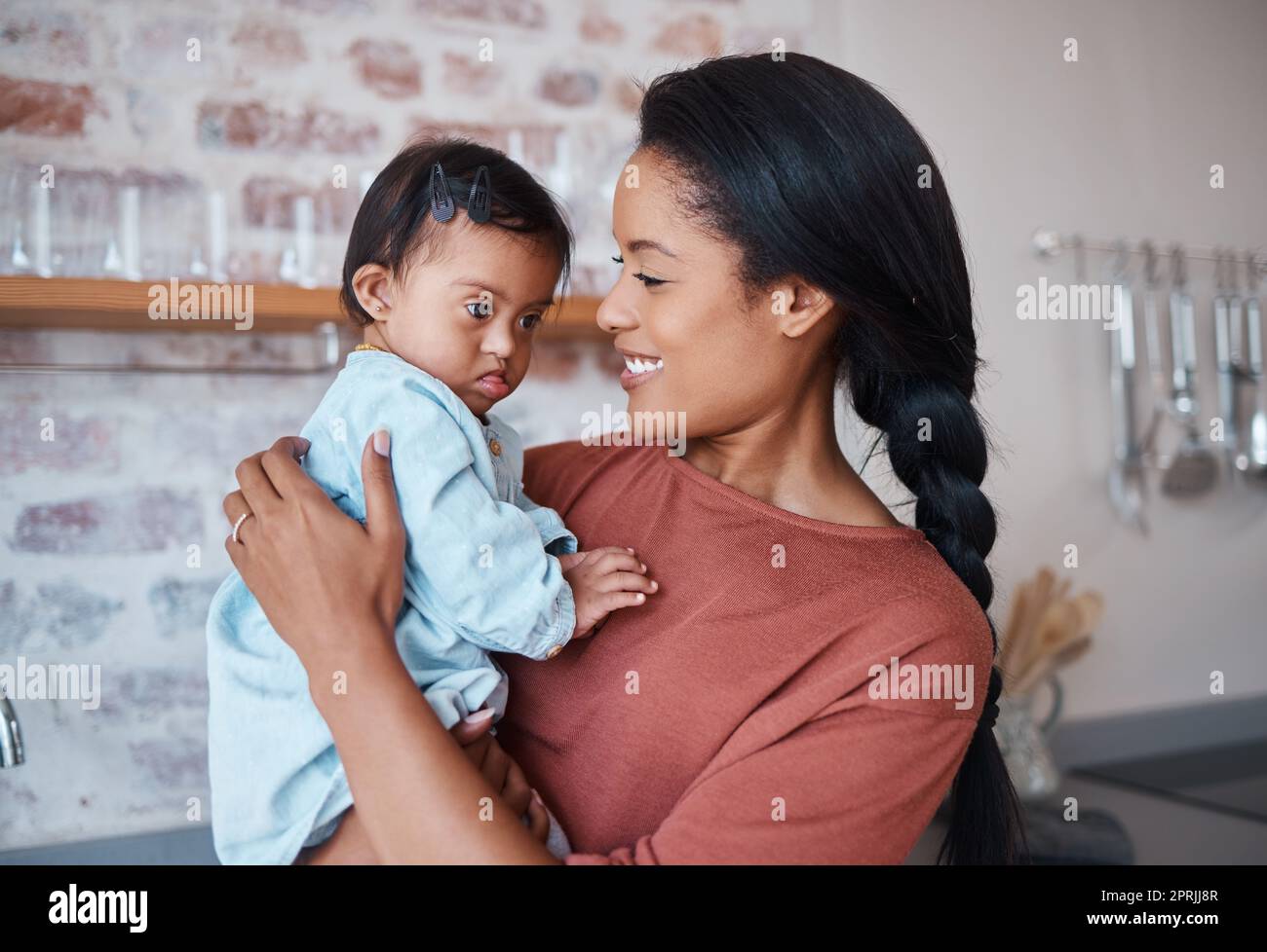 Disability baby and mother holding down syndrome child with love and